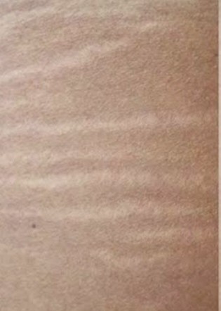 Hegfedő tetoválás előtte – hegszövet közelről